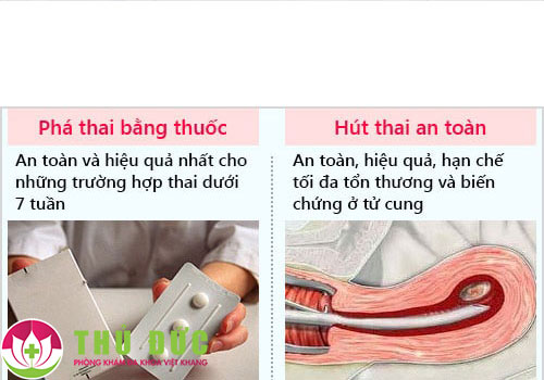 Phá thai 6 tuần tuổi có tội không