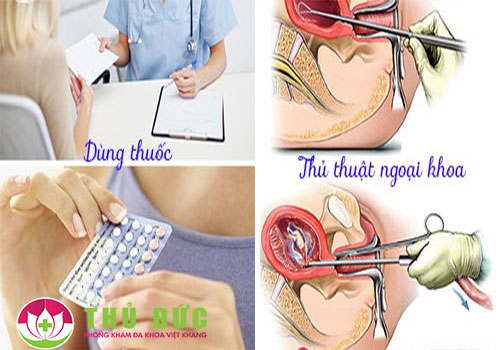 Phá thai ở đâu an toàn có bác sĩ giỏi, chi phí minh bạch?